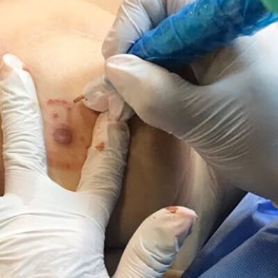 Tatuagem Clínica Tatuagem_Clínica.jpg